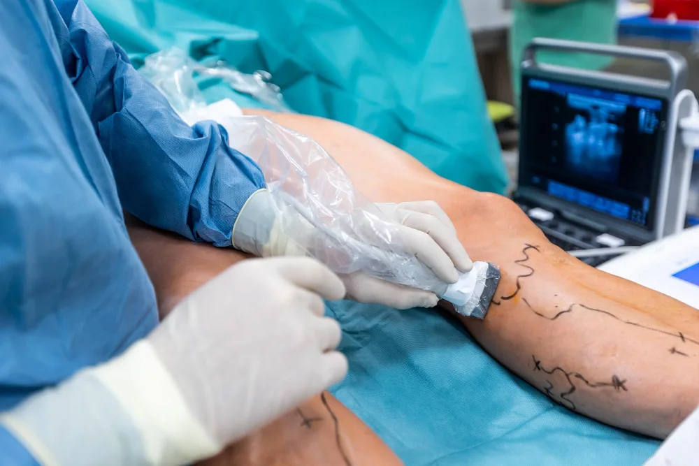 Estudio de USG Doppler vascular en Naucalpan
